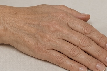 Handrücken mit feiner Hautstruktur